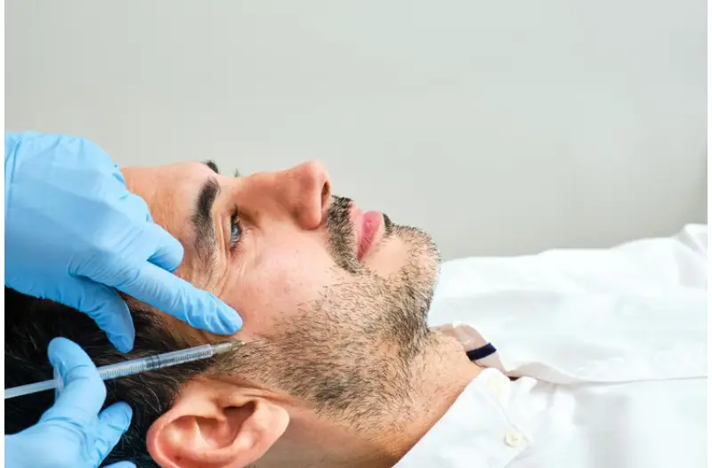 Beard transplant in Istanbul 
