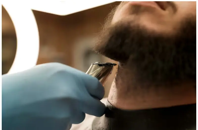 Beard transplant in Istanbul