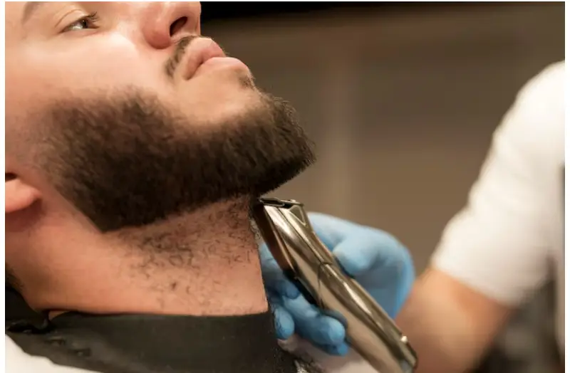 Beard transplant in Istanbul